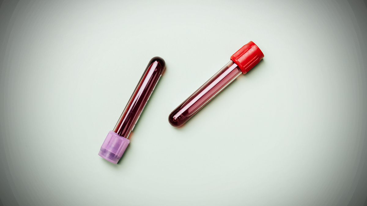 image of blood samples